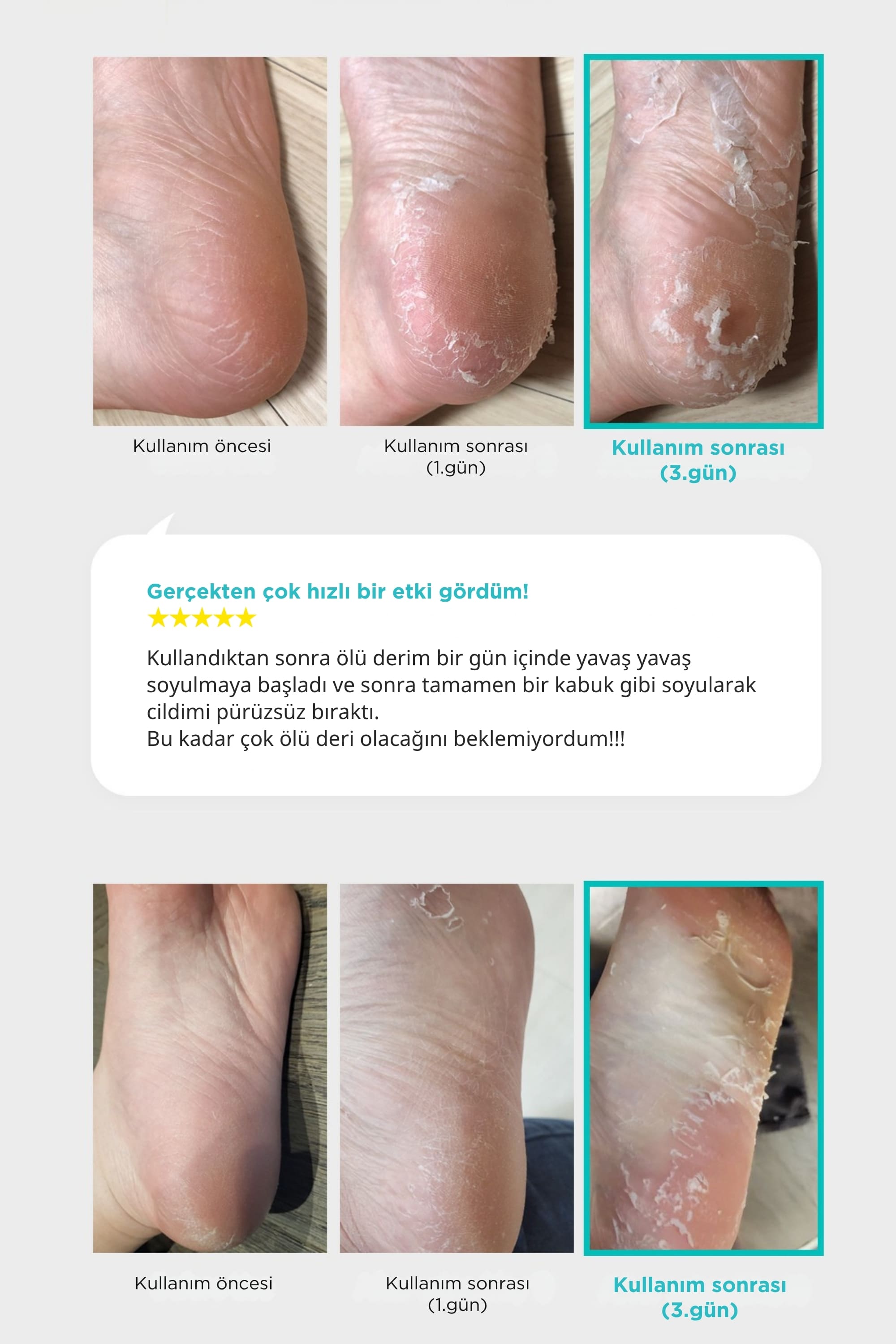 Ariul Smooth & Pure Foot Peeling Mask Nourishing 2 Pairs - Çorap Tipi Yoğun Besleyici Ayak Peeling Maskesi 2 Çift (4 Adet)