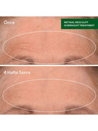 Murad Retinal Resculpt Overnight Treatment
