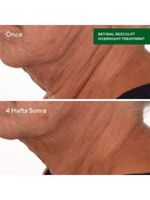Murad Retinal Resculpt Overnight Treatment